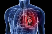 新型冠状病毒肺炎疫情防控期间因妨害疫情防控人员依法执行公务被判罪